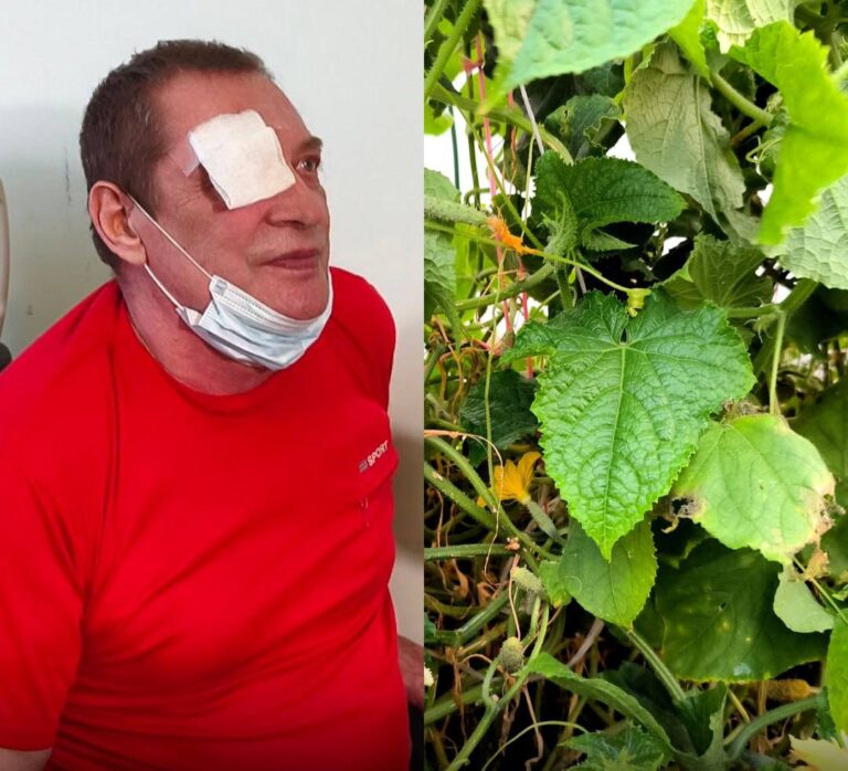 Дачник лишился зрения из-за огуречного листа